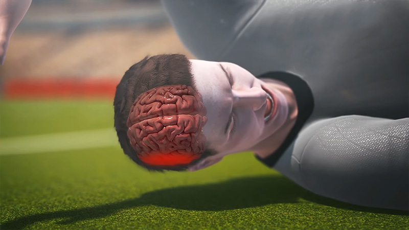 Do Rugby Players Get Cte