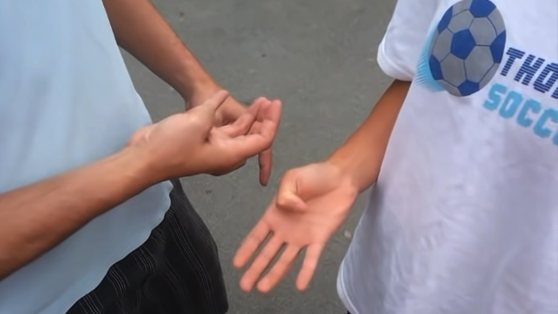 Thumb Hurt After Playing Volleyball