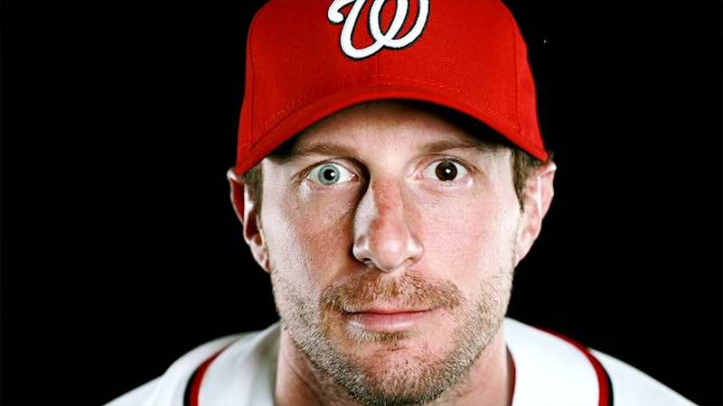 Max Scherzer Have Two Different Colored Eyes